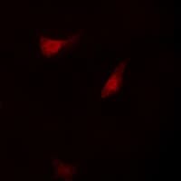 Polyclonal Rabbit anti-Human RPS6KB1 / P70S6K / S6K Antibody (Internal, IHC, IF, WB)