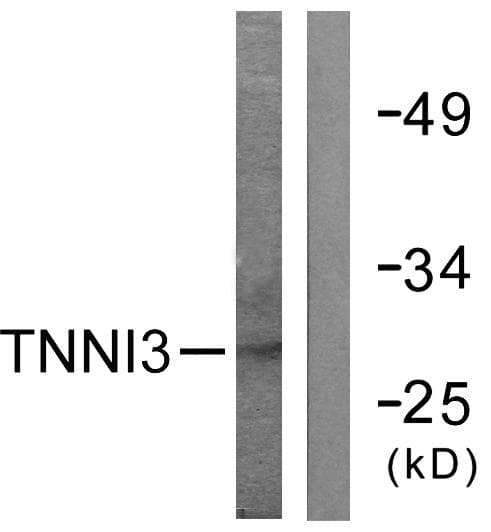 Polyclonal Rabbit anti-Human TNNI3 / Cardiac Troponin I Antibody (p142, IHC, WB)