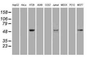 STK39 / SPAK Antibody (clone OTI4E3)