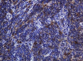 SOAT2 Antibody (clone OTI2D3)
