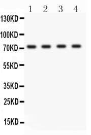 SELP / P-Selectin / CD62P Antibody (aa42-271)