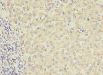 Polyclonal Rabbit anti-Human RAB17 Antibody (IHC, WB)
