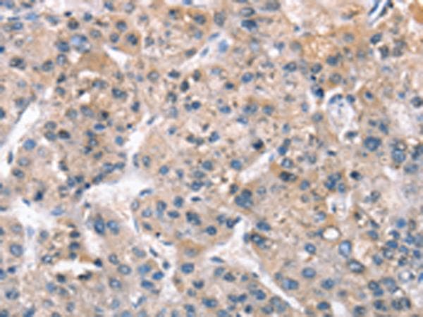 ZFYVE19 Antibody