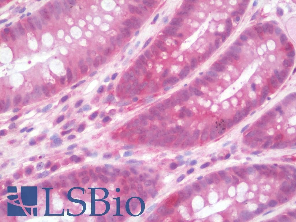 IHC-plus™ IL36RN / IL1F5 Antibody