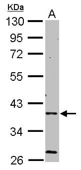 PRKAG2 / AMPK Gamma 2 Antibody (aa192-569)