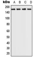 ROCK2 Antibody (C-Terminus)