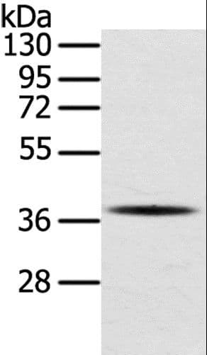 Osteonectin / SPARC Antibody (aa18-303)