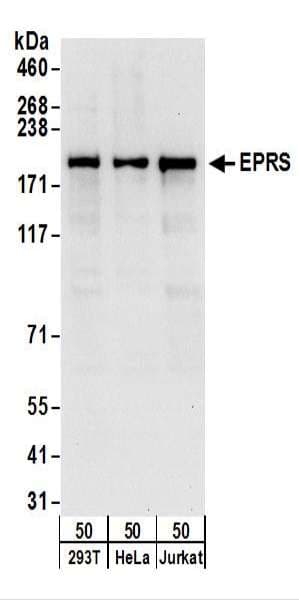 EPRS / PARS Antibody (aa150-200)
