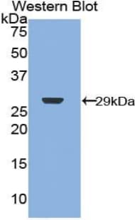 NF2 / Merlin Antibody (aa30-239)