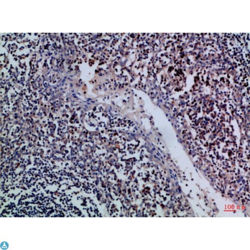 Polyclonal Rabbit anti-Human GZMM / Granzyme M Antibody (WB)