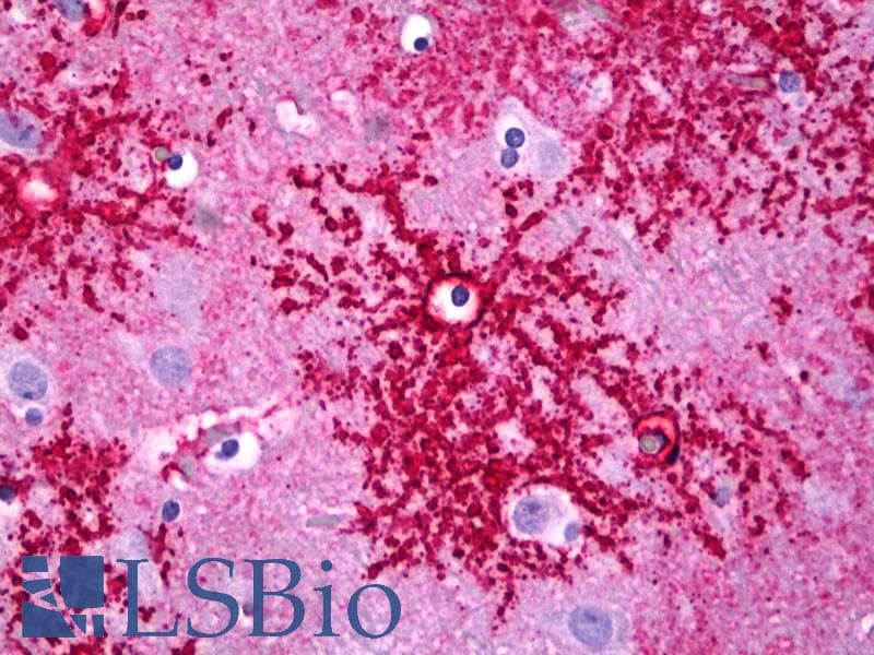 PathPlus™ Monoclonal Mouse anti-Human SLC1A2 / EAAT2 / GLT-1 Antibody (C-Terminus, IHC, WB)
