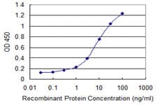 Monoclonal Mouse anti-Human SGCG / Gamma-Sarcoglycan Antibody (clone 3C5, WB)