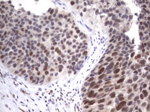 Monoclonal Mouse anti-Human APC Antibody (clone OTI1B12, aa955-1382, IHC)