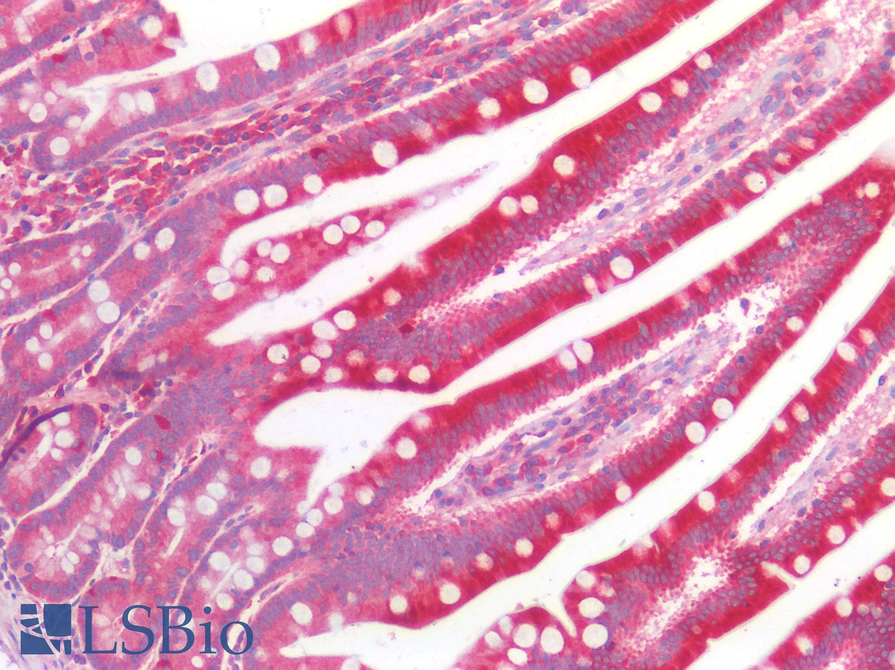 IHC-plus™ Polyclonal Rabbit anti-Human CYBB / NOX2 / gp91phox Antibody (IHC)