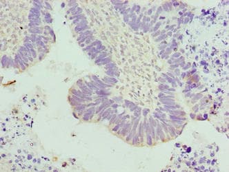 TUBA3E / Tubulin Alpha 3E Antibody