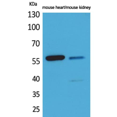 ANGPTL1 + ANGPTL2 Antibody (81-130 aa, Internal)