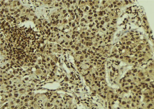Polyclonal Rabbit anti-Human URI1 / NNX3 Antibody (IHC, IF, WB)