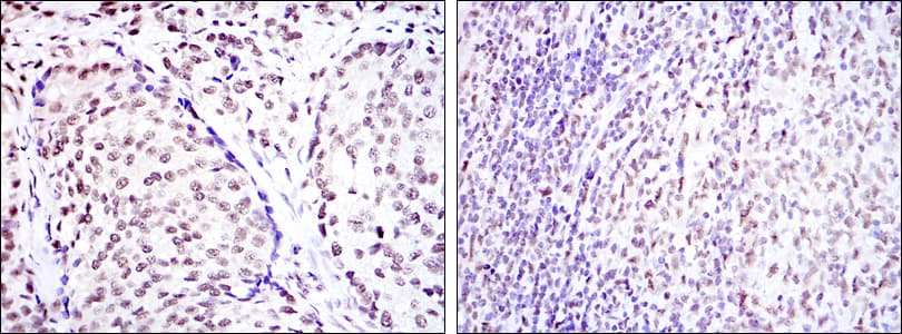 Monoclonal Mouse anti-Human CREB1 / CREB Antibody (clone 5G3, IHC, IF, WB)