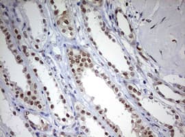 TOP2A / Topoisomerase II Alpha Antibody (aa1100-1531, clone OTI2A9)