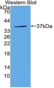 SULT1A1 / Sulfotransferase 1A1 Antibody (aa3-285, Biotin)