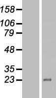 ZNF673 Protein (Over-Expression Lysate Myc-DDK (Flag))