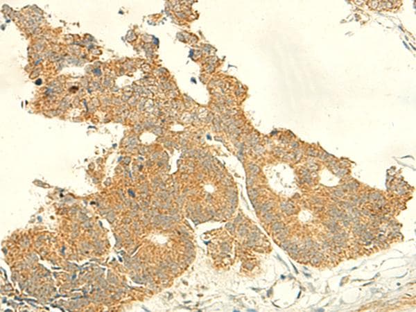 Polyclonal Rabbit anti-Human IFT27 / RABL4 Antibody (IHC)