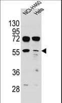 Polyclonal Rabbit anti-Human TSPYL6 Antibody (aa206-235, IHC, IF, WB)