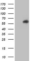 AKT1 Antibody (clone OTI4E10)