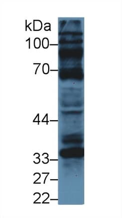 CCND1 / Cyclin D1 Antibody (aa72-272)