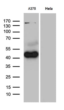 PHLDA1 Antibody (aa183-401, clone OTI4D9, Carrier-free)