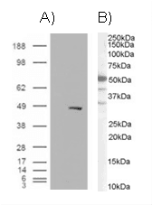 IHC-plus™ SMARCE1 / BAF57 Antibody (aa364-376)