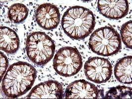 NFKBIA / IKB Alpha / IKBA Antibody (clone OTI2F5)