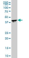 IHC-plus™ RPL4 / Ribosomal Protein L4 Antibody (clone 4A3)