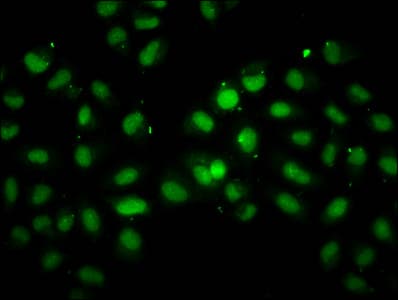 Polyclonal Rabbit anti-Human INO80 Antibody (IF, WB)