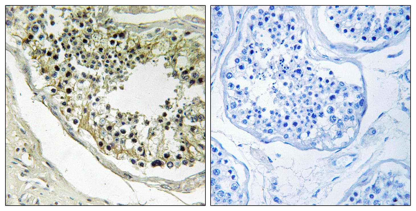 RFPL4B Antibody