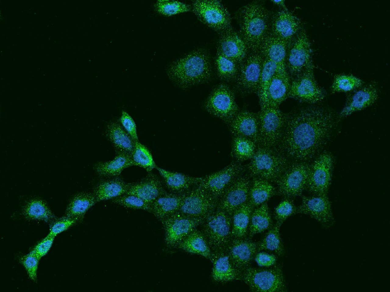 Polyclonal Rabbit anti-Human Dynactin 2 / Dynamitin Antibody (IHC, IF)