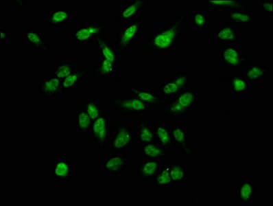 H2AFX / H2AX Antibody (phospho-Ser139)