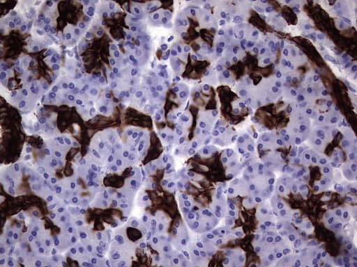 KRT19 / CK19 / Cytokeratin 19 Antibody (aa240-390, clone OTI1C11)