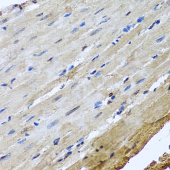 Polyclonal Rabbit anti-Human NUMA1 / NUMA Antibody (IHC, IF, WB)