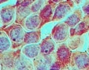 Polyclonal Rabbit anti-Human TIP49 / RUVBL1 Antibody (aa400-454, IHC, WB)
