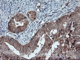 LIMK1 / LIMK Antibody (clone OTI3H6)