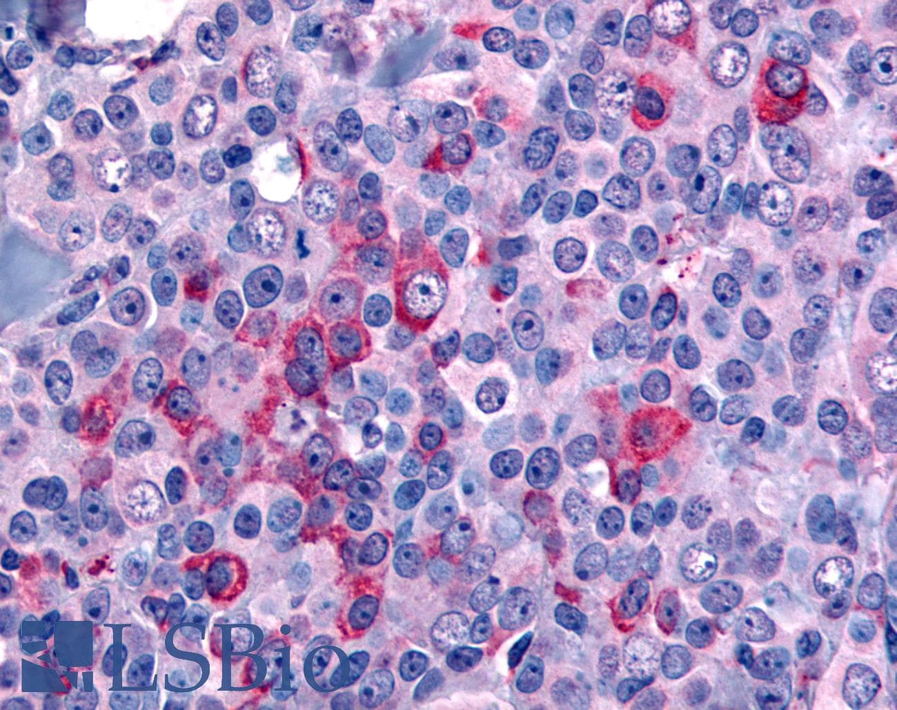 IHC-plus™ NANP Antibody (N-Terminus)