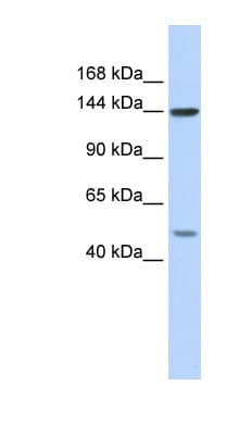 SF3B1 Antibody (aa287-336)