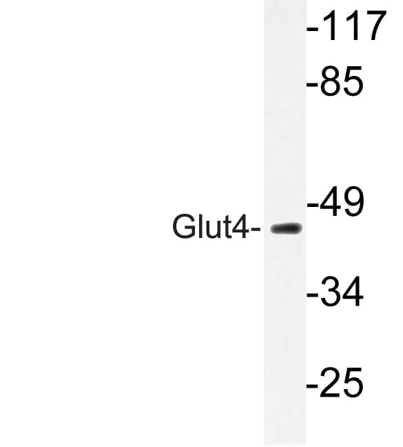 SLC2A4 / GLUT-4 Antibody (aa222-271)