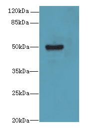 KRT80 / Keratin 80 Antibody