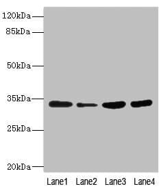 Polyclonal Rabbit anti-Human UFD1L Antibody (IHC, WB)