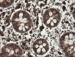 TAPBPL / TAPBPR Antibody (clone OTI4H5)