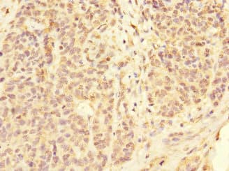 CD32C Antibody