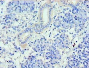 Polyclonal Rabbit anti-Human WDR77 / MEP50 Antibody (aa1-260, IHC, WB)