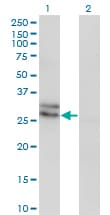 IHC-plus™ Monoclonal Mouse anti-Human Endothelin 3 / EDN3 Antibody (clone 2A6-2A4, IHC, WB)